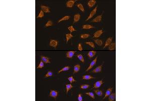 Immunofluorescence analysis of L929 cells using Kininogen 1 (Kininogen 1 (KNG1)) Rabbit pAb (ABIN3022363, ABIN3022364, ABIN3022365 and ABIN6218762) at dilution of 1:100 (40x lens). (KNG1 抗体  (AA 148-427))