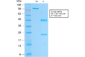 SDS-PAGE Analysis Purified PSAP Mouse Monoclonal Antibody (rACPP/1338). (Recombinant ACPP 抗体)