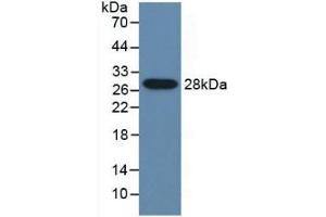 WB of Protein Standard: different control antibodies against Highly purified E. (CYP2E1 ELISA 试剂盒)