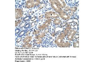 Rabbit Anti-C9orf127 Antibody  Paraffin Embedded Tissue: Human Kidney Cellular Data: Epithelial cells of renal tubule Antibody Concentration: 4. (TMEM8B 抗体  (N-Term))