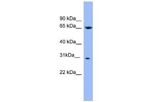 Western Blotting (WB) image for anti-NADH Dehydrogenase (Ubiquinone) Fe-S Protein 3, 30kDa (NADH-Coenzyme Q Reductase) (NDUFS3) (Middle Region) antibody (ABIN2786780)