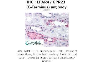 Image no. 1 for anti-Lysophosphatidic Acid Receptor 4 (LPAR4) (C-Term) antibody (ABIN1736524) (LPAR4 抗体  (C-Term))