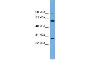 WB Suggested Anti-IMPDH2 Antibody Titration: 0. (IMPDH2 抗体  (N-Term))