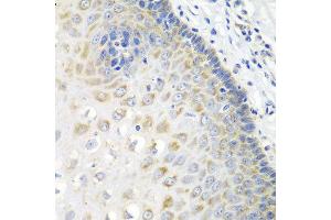 Immunohistochemistry of paraffin-embedded human esophagus using STXBP4 antibody at dilution of 1:100 (40x lens). (STXBP4 抗体)