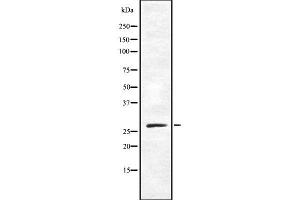 Western blot analysis OR10X1 using COLO205 whole cell lysates (OR10X1 抗体  (Internal Region))