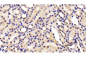 Detection of CHEM in Rat Kidney Tissue using Polyclonal Antibody to Chemerin (CHEM) (Chemerin 抗体  (AA 25-152))