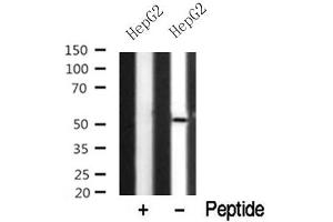 anti-NDR1/2 antibody