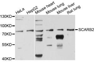 Western blot analysis of extracts of various cell lines, using SCARB2 antibody. (SCARB2 抗体)