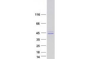 Western Blotting (WB) image for Short Stature Homeobox 2 (SHOX2) (Transcript Variant 3) protein (Myc-DYKDDDDK Tag) (ABIN2732009)