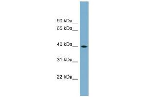 WB Suggested Anti-TSPAN17 Antibody Titration:  0. (Tetraspanin 17 抗体  (Middle Region))
