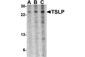 Western Blotting (WB) image for anti-Thymic Stromal Lymphopoietin (TSLP) (Middle Region) antibody (ABIN1031148) (Thymic Stromal Lymphopoietin 抗体  (Middle Region))
