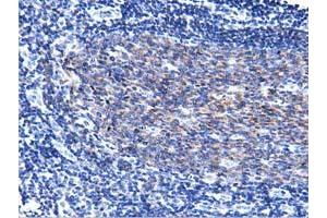 Immunohistochemical staining of paraffin-embedded Human lymph node tissue using anti-PIK3AP1 mouse monoclonal antibody.