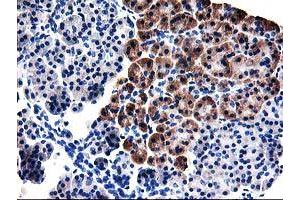 Immunohistochemical staining of paraffin-embedded Human pancreas tissue using anti-TBC1D21 mouse monoclonal antibody. (TBC1D21 抗体)