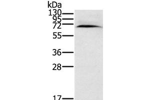 Western Blot analysis of Human normal kidney tissue using CYP11A1 Polyclonal Antibody at dilution of 1:200 (CYP11A1 抗体)