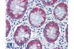 ABIN334341 (5µg/ml) staining of paraffin embedded Human Colon.