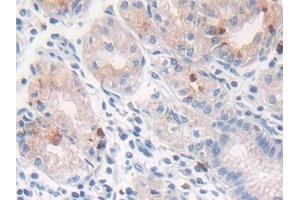 Detection of CTSG in Human Stomach Tissue using Polyclonal Antibody to Cathepsin G (CTSG)