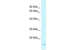 Western Blot showing LY96 antibody used at a concentration of 1 ug/ml against PANC1 Cell Lysate (LY96 抗体  (C-Term))