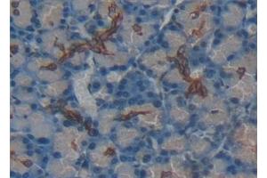 Detection of RANk in Rat Pancreas Tissue using Polyclonal Antibody to Receptor Activator Of Nuclear Factor Kappa B (RANk)