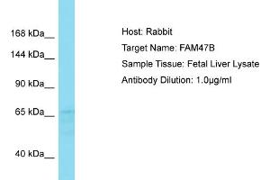Host: Rabbit Target Name: FAM47B Sample Type: Fetal Liver lysates Antibody Dilution: 1. (FAM47B 抗体  (C-Term))
