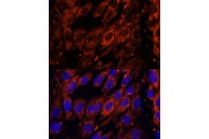 Immunofluorescence analysis of C6 cells using PDE6G antibody (ABIN7269304) at dilution of 1:100. (PDE6G 抗体  (AA 1-87))