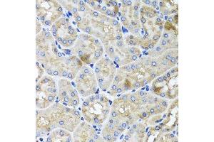 Immunohistochemistry of paraffin-embedded mouse kidney using USH1C antibody.