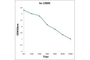 Antigen: 0. (Menin 抗体  (AA 501-615))