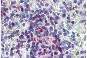Human Spleen: Formalin-Fixed, Paraffin-Embedded (FFPE) (KDM4C 抗体  (C-Term))