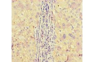 Immunohistochemistry of paraffin-embedded human liver tissue using ABIN7150160 at dilution of 1:100