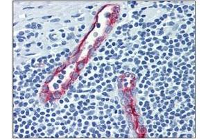 Immunohistochemistry (IHC) image for anti-Selectin P (Granule Membrane Protein 140kDa, Antigen CD62) (SELP) antibody (ABIN316863) (P-Selectin 抗体)