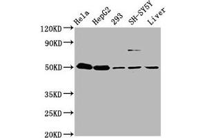 Western Blot Positive WB detected in: Hela whole cell lysate, HepG2 whole cell lysate, 293 whole cell lysate, SH-SY5Y whole cell lysate, Mouse liver tissue All lanes: DYM antibody at 3. (Dymeclin 抗体  (AA 224-348))