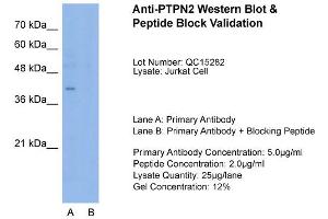 Host:  Rabbit  Target Name:  PTPN2  Sample Type:  Jurkat  Lane A:  Primary Antibody  Lane B:  Primary Antibody + Blocking Peptide  Primary Antibody Concentration:  5. (PTPN2 抗体  (N-Term))