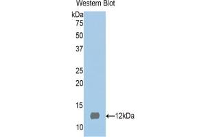 Western blot analysis of the recombinant protein. (S100 Protein (S100) (AA 2-94) 抗体)