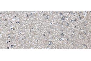 Immunohistochemistry of paraffin-embedded Human brain tissue using PRAME Polyclonal Antibody at dilution of 1:65(x200) (PRAME 抗体)
