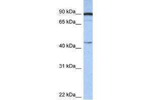 Human Brain; WB Suggested Anti-PSMD6 Antibody Titration: 0. (PSMD6 抗体  (N-Term))