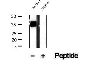 Western blot analysis of extracts of MCF-7 cells, using RQCD1 antibody. (RQCD1 抗体  (Internal Region))
