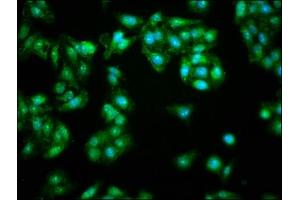 Immunofluorescence staining of HepG2 cells with ABIN7145619 at 1:166, counter-stained with DAPI. (FHIT 抗体  (AA 2-147))