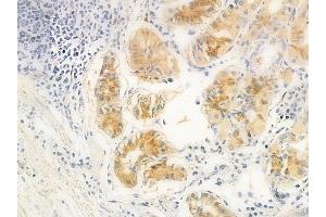 ABIN6261924 and ABIN6266907 at 1/100 staining human normal gastric tissue by IHC-P. (GUCY1B3 抗体  (N-Term))