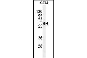 Western blot analysis in CEM cell line lysates (35ug/lane). (DOK3 抗体  (C-Term))