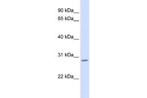 WB Suggested Anti-AEBP2 Antibody Titration: 0. (AEBP2 抗体  (C-Term))