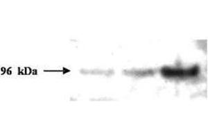 Image no. 1 for anti-PMS2 Postmeiotic Segregation Increased 2 (S. Cerevisiae) (PMS2) (AA 58-81) antibody (ABIN296611)