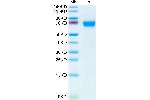 Human CD46 on Tris-Bis PAGE under reduced condition. (CD46 Protein (CD46) (AA 35-343) (His tag))