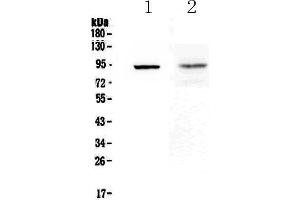 Western blot analysis of TLR1 using anti-TLR1 antibody . (TLR1 抗体  (AA 350-404))