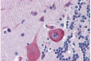 Human Brain, Cerebellum (formalin-fixed, paraffin-embedded) stained with CBLN4 antibody ABIN462251 followed by biotinylated goat anti-rabbit IgG secondary antibody ABIN481713, alkaline phosphatase-streptavidin and chromogen. (CBLN4 抗体  (AA 125-174))