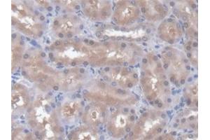 Detection of CD7 in Rat Kidney Tissue using Polyclonal Antibody to Cluster Of Differentiation 7 (CD7) (CD7 抗体  (AA 23-128))