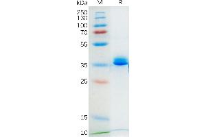 SDS-PAGE (SDS) image for G Protein-Coupled Receptor, Family C, Group 5, Member D (GPRC5D) (AA 1-21) protein (Fc Tag) (ABIN7490619)