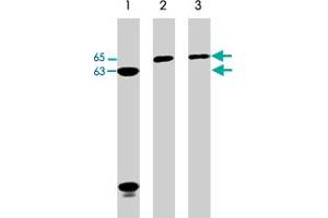 Western blot analysis of Jurkat (lane 1), A-431 (lane 2), and HeLa (lane 3) cell lysates (20 ug/lane). (Neural Wiskott-Aldrich syndrome protein (WASL) (C-Term) 抗体)