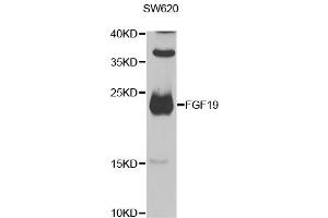 Western blot analysis of extracts of SW620 cells, using FGF19 antibody (ABIN5975040) at 1/1000 dilution. (FGF19 抗体)