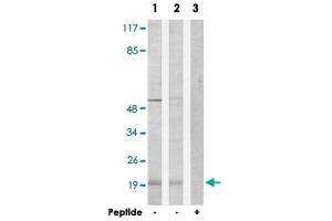 Western blot analysis of extracts from Jurkat cells (Lane 1) and COLO 205 cells (Lane 2 and lane 3), using PPP1R14C polyclonal antibody . (PPP1R14C 抗体)