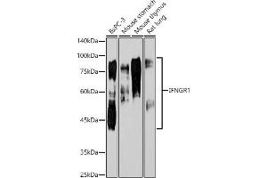 Western blot analysis of extracts of various cell lines, using IFNGR1 antibody  at 1:1000 dilution. (IFNGR1 抗体)