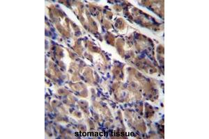 ABRA Antibody (C-term) immunohistochemistry analysis in formalin fixed and paraffin embedded human stomach tissue followed by peroxidase conjugation of the secondary antibody and DAB staining. (ABRA 抗体  (C-Term))